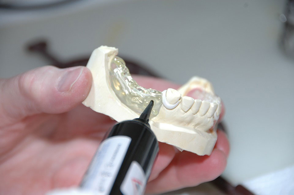 Prothésiste Dentaire